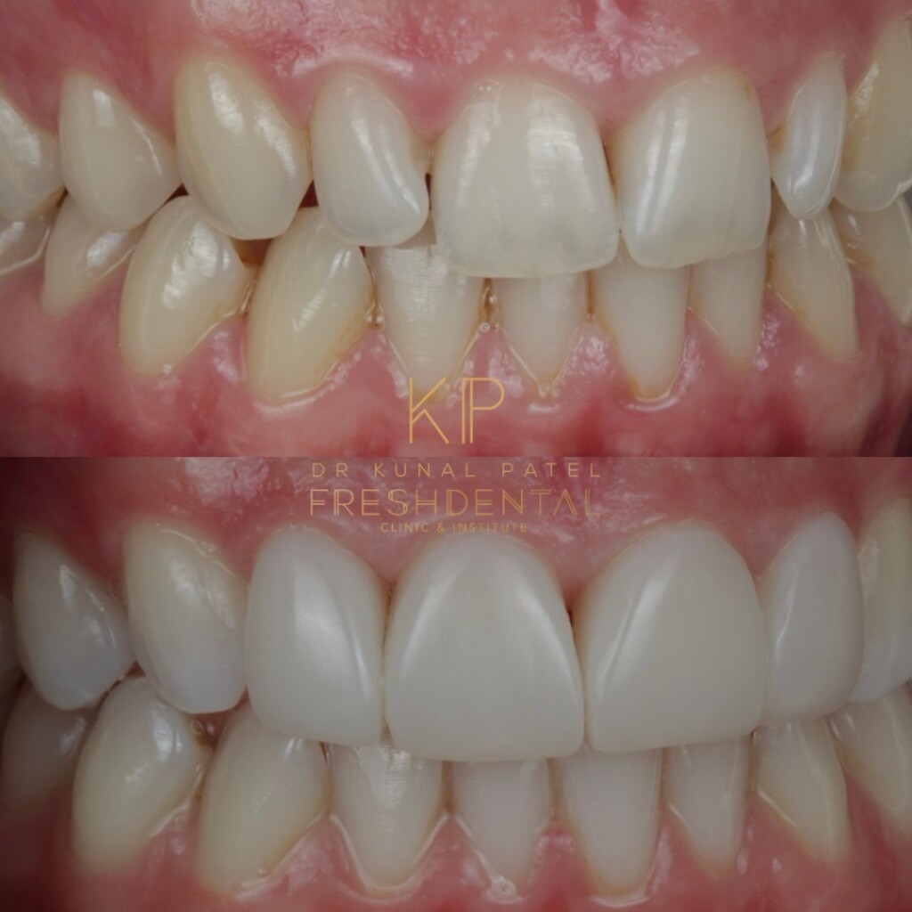 Fresh Dental smile result