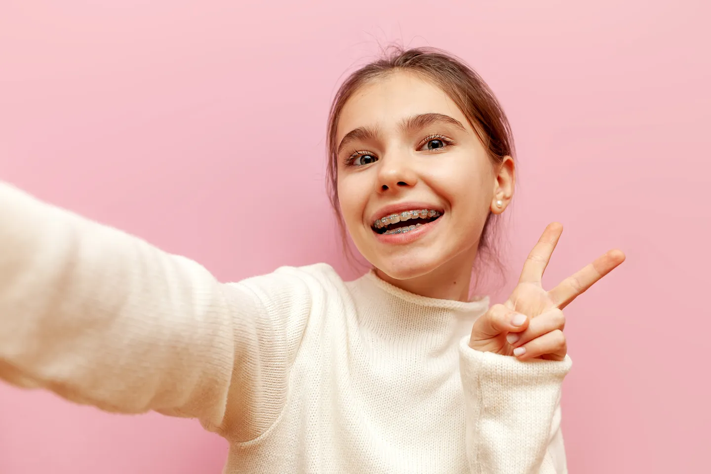 Fixed braces for children at Fresh Dental