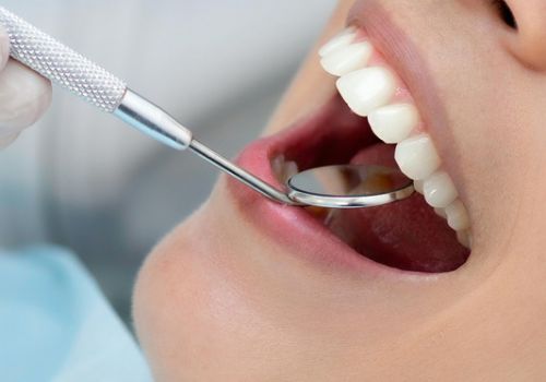 To repair chipped teeth