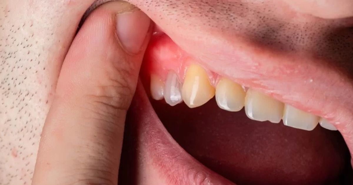 Teeth and gums