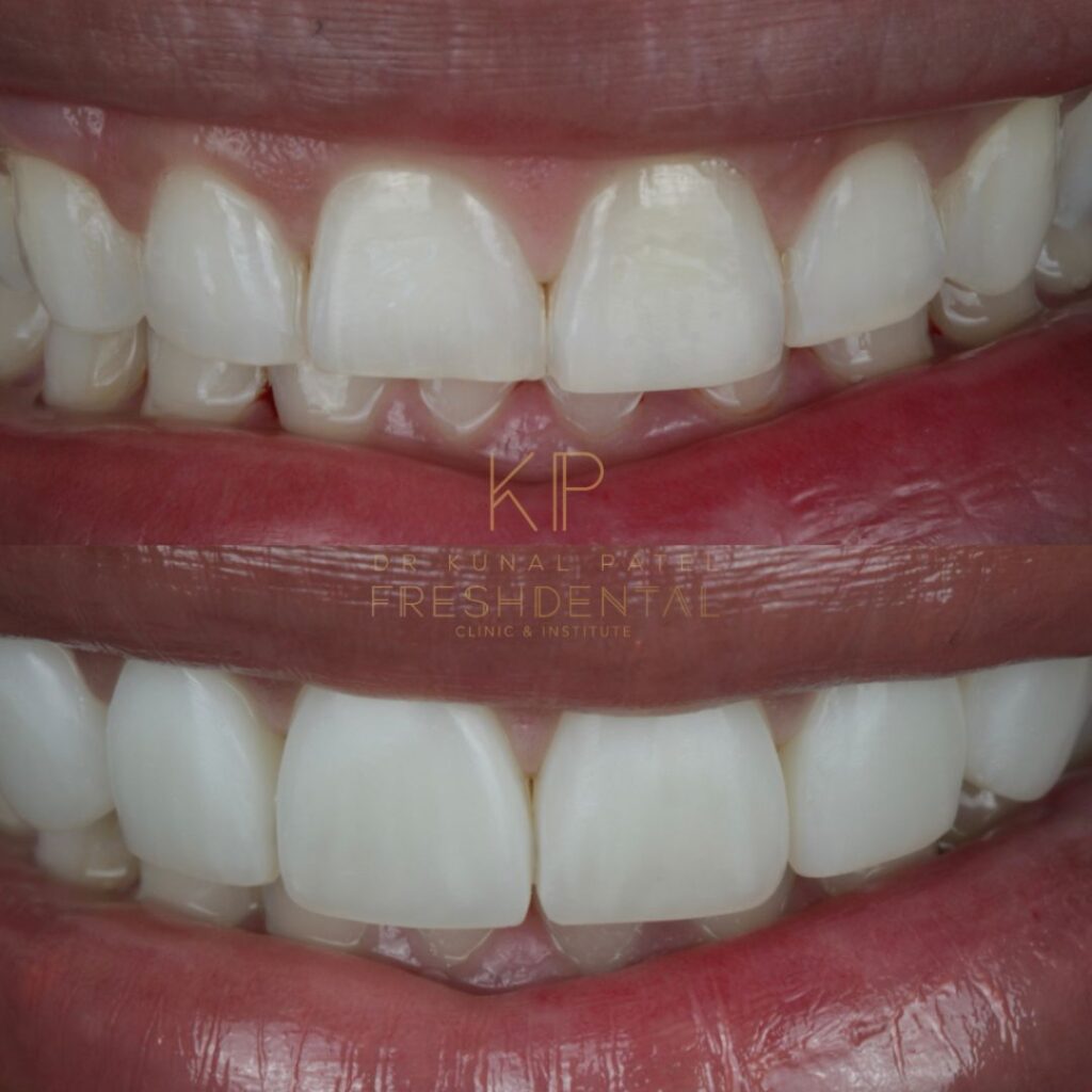 Fresh Dental smile result