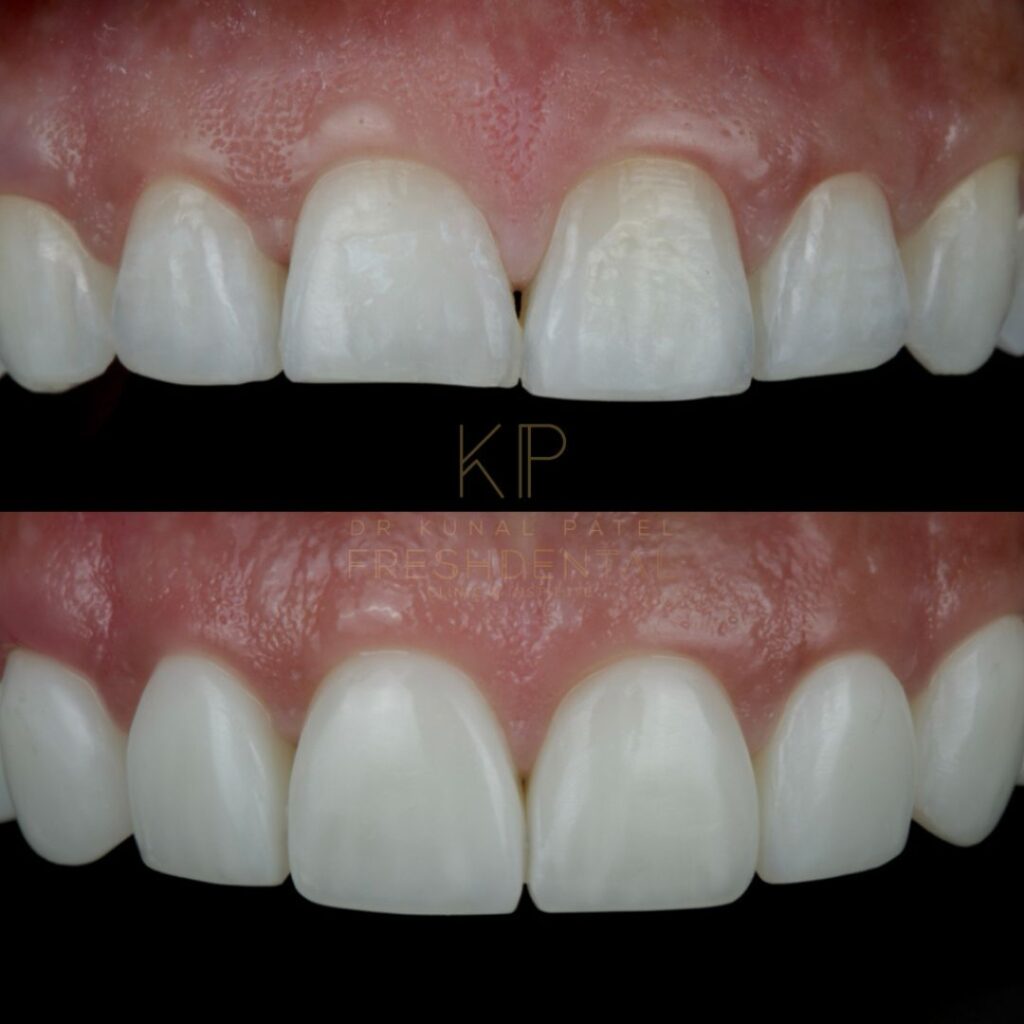 Fresh Dental smile result