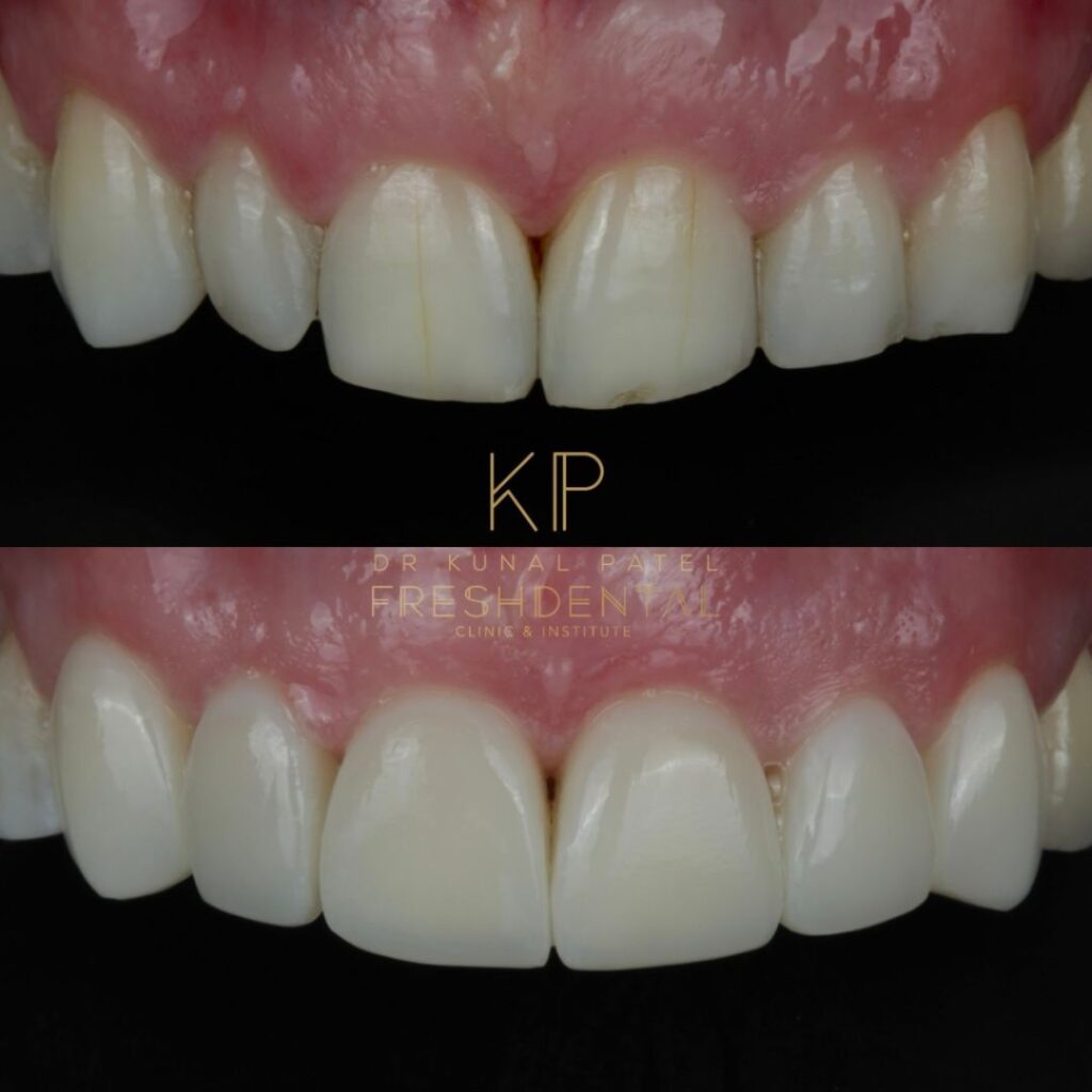 Fresh Dental smile result