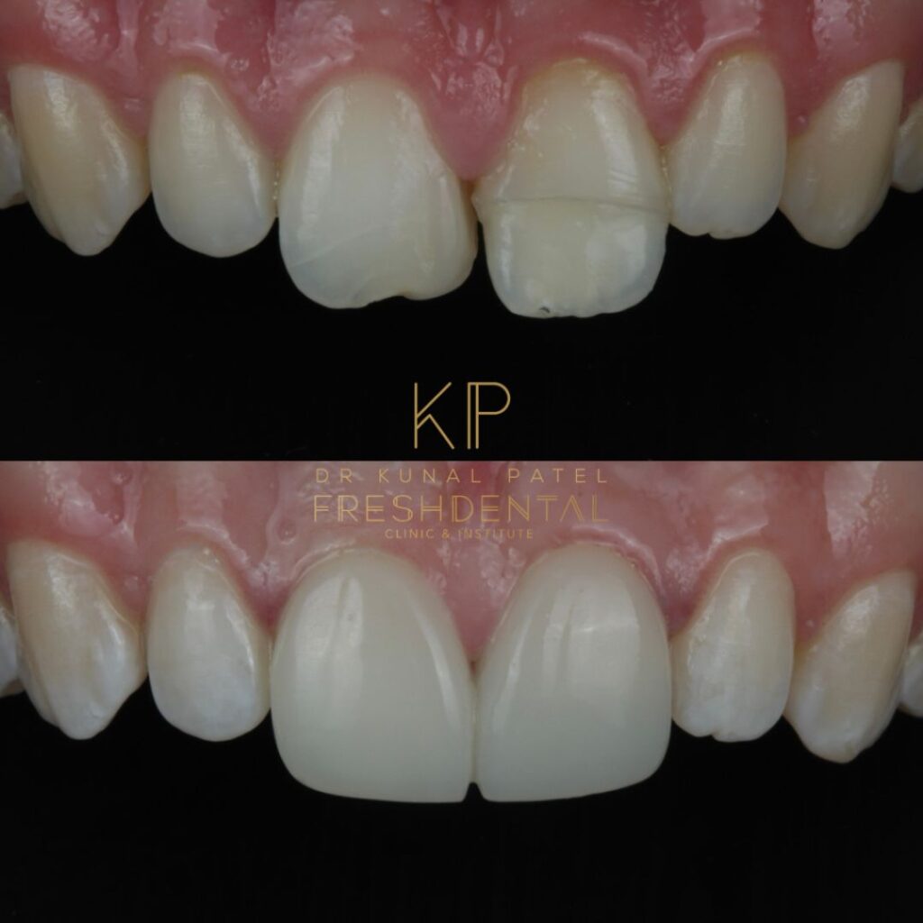 Fresh Dental smile result