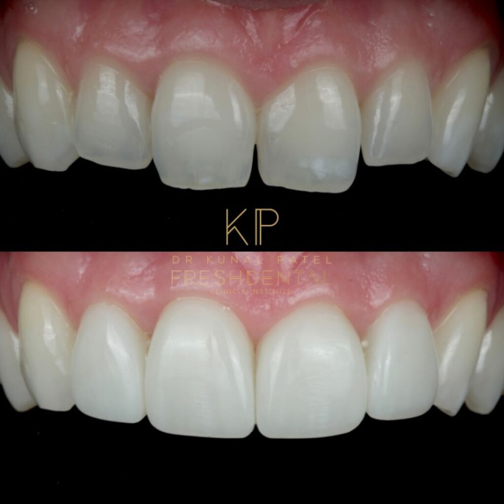 Fresh Dental smile result