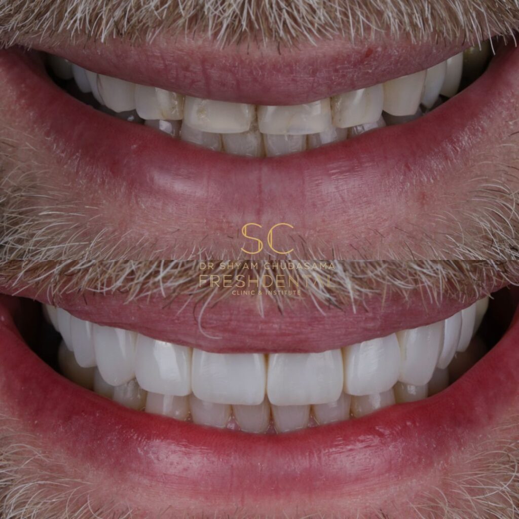 Fresh Dental smile result