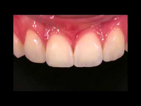 The Totally Composite course by Dr Monik Vasant