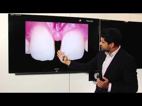 MIRIS2 - clinical cases - Dr. Monik Vasant - English